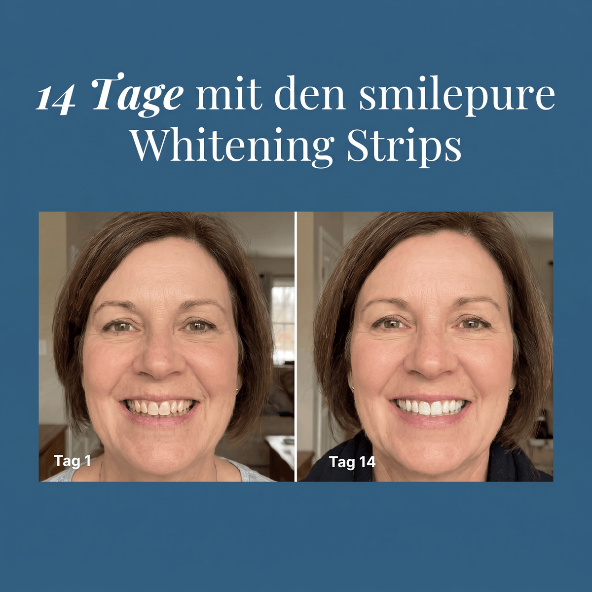14 Tage mit den smilepure Whitening Strips