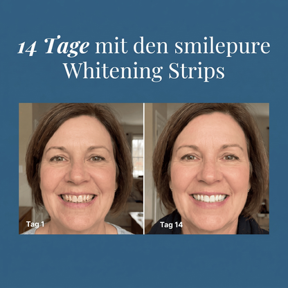 14 Tage mit den smilepure Whitening Strips